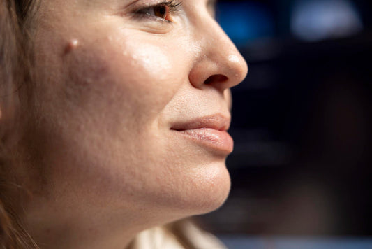 Treating Facial Pallor, Cheek Filling, and Wrinkle Reduction: Effective Tips and Steps