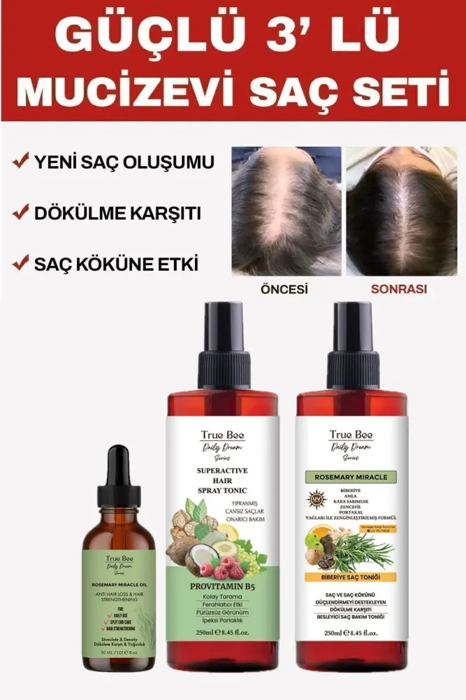 DAİLY DREAM CARE Güçlü 3’lü Mucizevi Saç Seti Biberiye Tonik Sirkeli Tonik Biberiye Kompleks Yağ 30 ml - 1