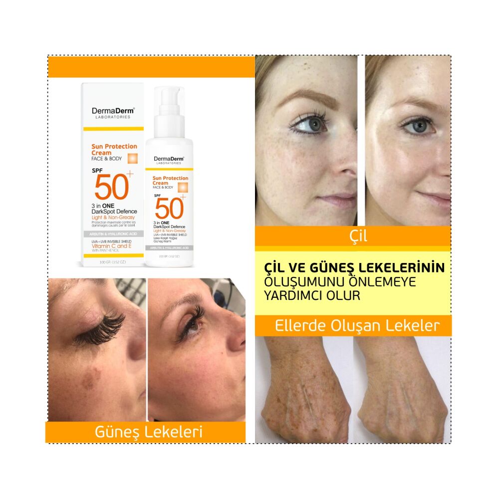 Dermaderm SPF 50+ Lekelere Özel Güneş Kremi - 3