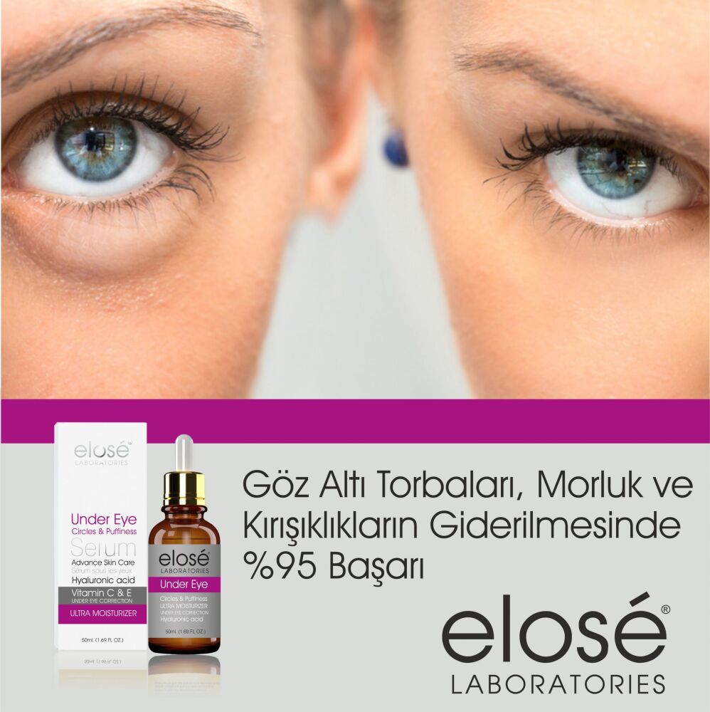 Elose göz altı serumu 50 ml - 2